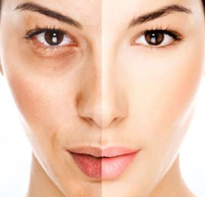 ciltteki lekelerin tedavisi