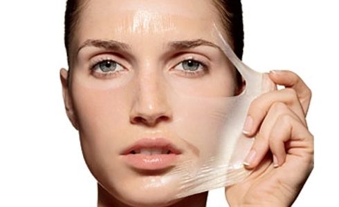 kimyasal peeling
